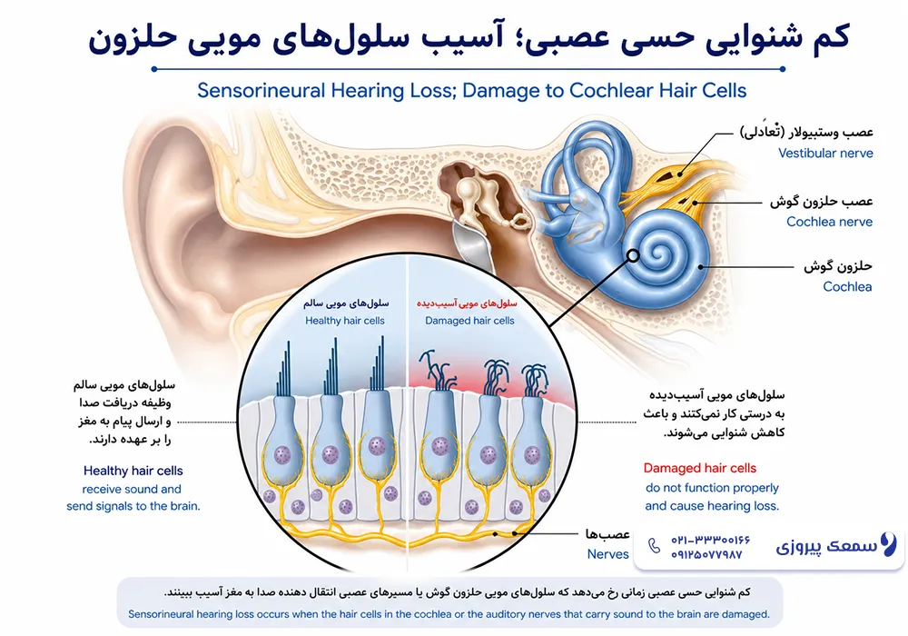 بهترین سمعک برای کم شنوایی حسی عصبی